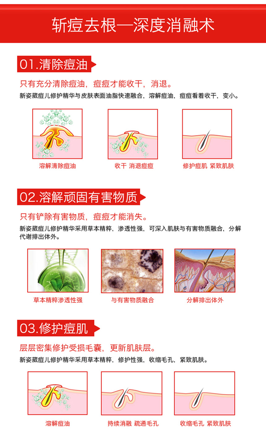 痘兒修護精華（女士）860詳情圖_07.jpg