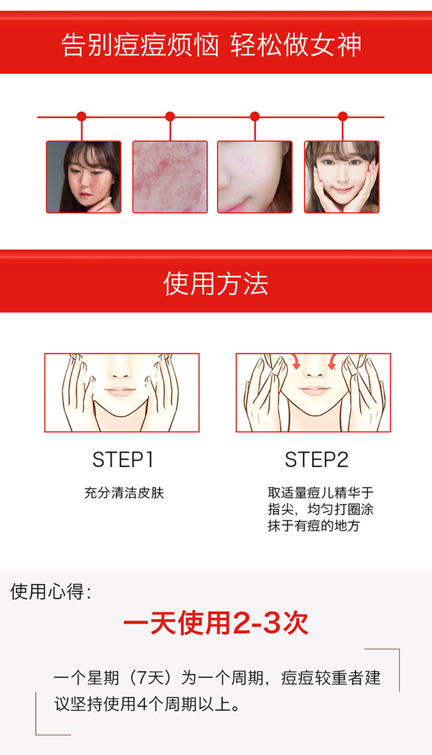 痘兒修護精華（女士）860詳情圖_08.jpg