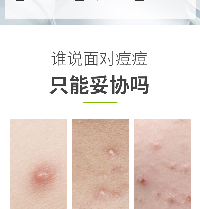 祛痘修護精華霜詳情頁_02.jpg