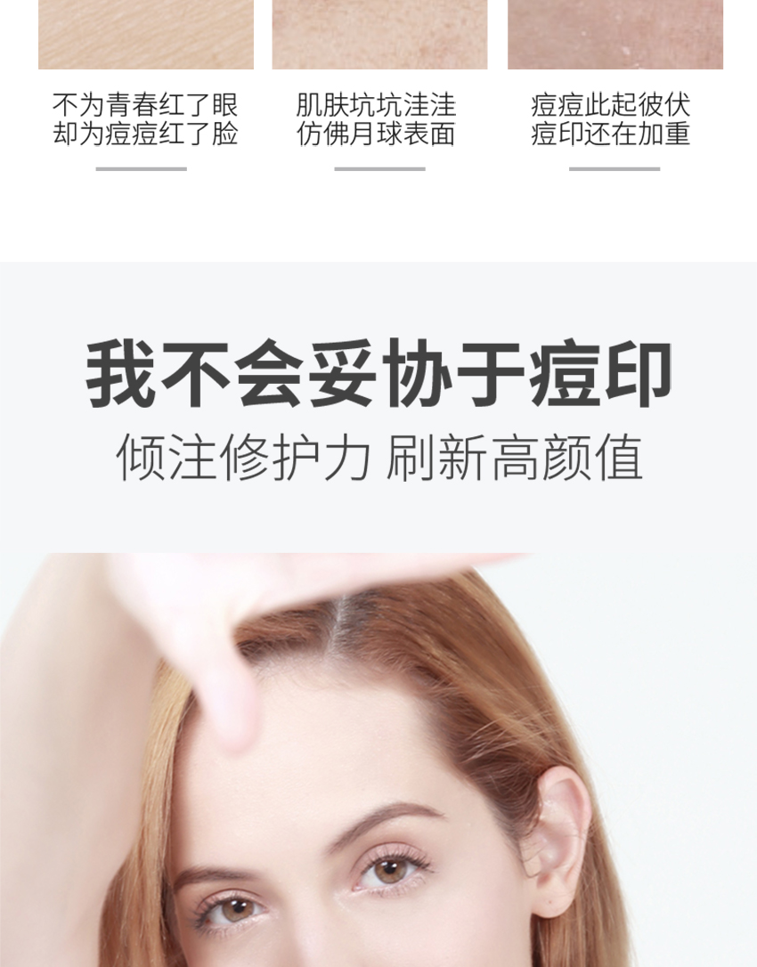 祛痘修護精華霜詳情頁_03.jpg