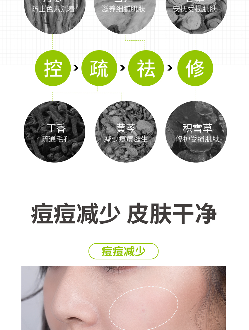祛痘修護精華霜詳情頁_07.jpg
